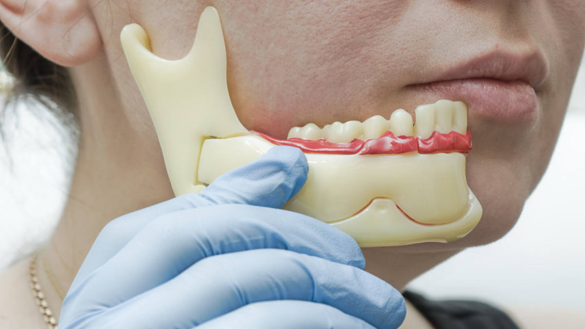 Çene Eklemi Tıklaması ve Kütlemesi Neden Olur Nasıl Tedavi Edilir?