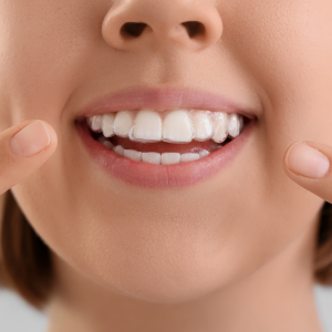 Diş Gıcırdatma Tedavisinde Botoks Uygulaması