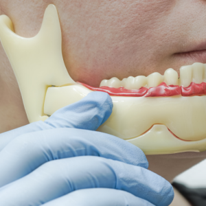 Çene Eklemi Tıklaması ve Kütlemesi Neden Olur Nasıl Tedavi Edilir?