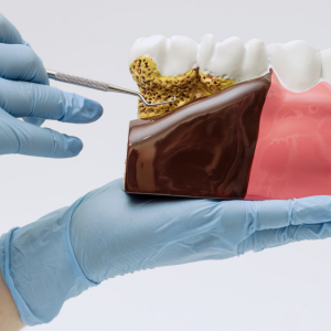 Diş Eti Sağlığı ile Hafıza ve Beyin Fonksiyonları Arasındaki Bağlantı