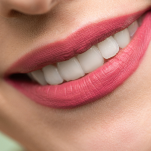 Hollywood Smile Sonrası Doğal Görünüm Mümkün mü?