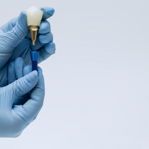 İmplant Tedavisinde Başarı Oranını Artıran Faktörler