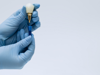 İmplant Tedavisinde Başarı Oranını Artıran Faktörler