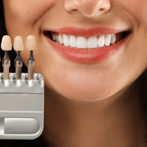 Estetik Diş Kaplamalarının Kullanım Ömrü Nasıl Uzatılır?