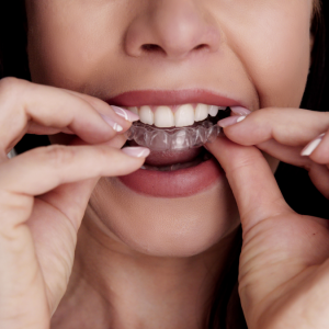 Uykuda Diş Gıcırdatma (Bruksizm) İçin Ağız Plakları