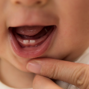 Çocuklarda Diş Çıkarma Süreci ve Ailelere Destek İpuçları