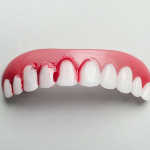 Diş Eti Çekilmesinde Serbest Diş Eti Greftleme İşlemi